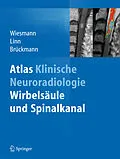 E-Book (pdf) Atlas Klinische Neuroradiologie von Martin Wiesmann, Jennifer Linn, Hartmut Brückmann