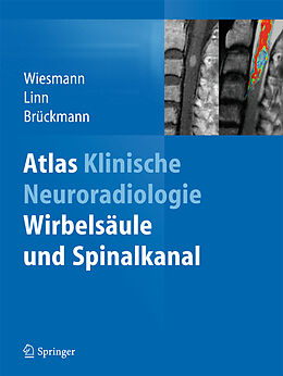 E-Book (pdf) Atlas Klinische Neuroradiologie von Martin Wiesmann, Jennifer Linn, Hartmut Brückmann