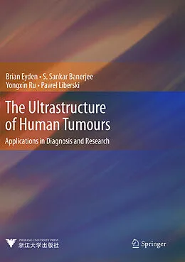 E-Book (pdf) The Ultrastructure of Human Tumours von Brian Eyden, S. Sankar Banerjee, Yongxin Ru