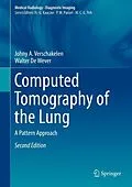 E-Book (pdf) Computed Tomography of the Lung von Johny A. Verschakelen, Walter De Wever
