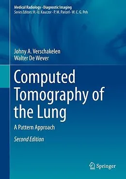 E-Book (pdf) Computed Tomography of the Lung von Johny A. Verschakelen, Walter De Wever