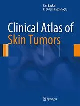Fester Einband Clinical Atlas of Skin Tumors von Can Baykal, K. Didem Yazganoglu