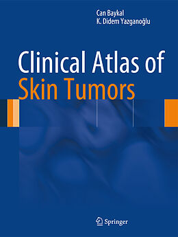 Fester Einband Clinical Atlas of Skin Tumors von Can Baykal, K. Didem Yazganoglu