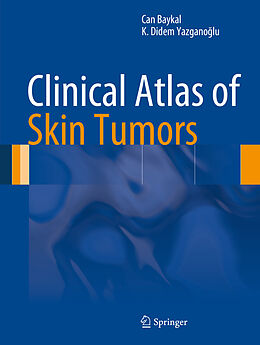 E-Book (pdf) Clinical Atlas of Skin Tumors von Can Baykal, K. Didem Yazganoglu
