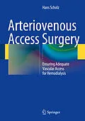 E-Book (pdf) Arteriovenous Access Surgery von Hans Scholz