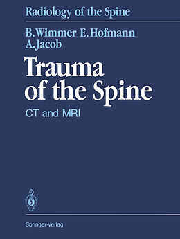 Kartonierter Einband Trauma of the Spine von Berthold Wimmer, Augustinus L. H. Jacob, Erich Hofmann
