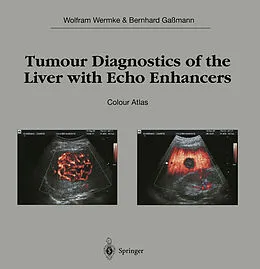 E-Book (pdf) Tumour Diagnostics of the Liver with Echo Enhancers von Wolfram Wermke, Bernhard Gaßmann