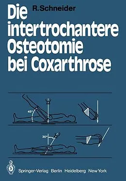 E-Book (pdf) Die intertrochantere Osteotomie bei Coxarthrose von R. Schneider