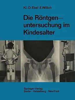 E-Book (pdf) Die Röntgenuntersuchung im Kindesalter von Klaus-Dietrich Ebel, Eberhard Willich