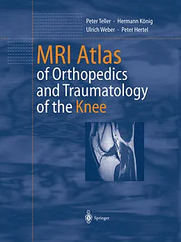 E-Book (pdf) MRI Atlas of Orthopedics and Traumatology of the Knee von Peter Teller, Hermann König, Ulrich Weber