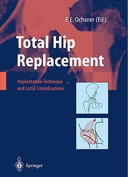 E-Book (pdf) Total Hip Replacement von 