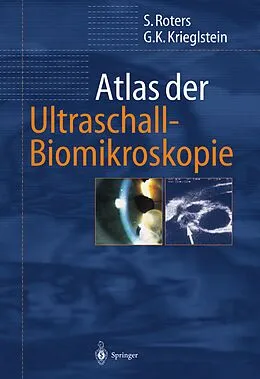 E-Book (pdf) Atlas der Ultraschall-Biomikroskopie von Sigrid Roters, Günter K. Krieglstein