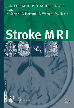E-Book (pdf) Stroke MRI von Jochen Fiebach, Peter Schellinger