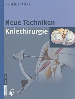 E-Book (pdf) Neue Techniken Kniechirurgie von H.H. Pässler