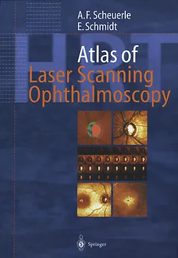 E-Book (pdf) Atlas of Laser Scanning Ophthalmoscopy von Alexander Friedrich Scheuerle, Eckart Schmidt