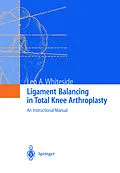 E-Book (pdf) Ligament Balancing in Total Knee Arthroplasty von Leo A. Whiteside