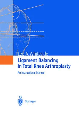 E-Book (pdf) Ligament Balancing in Total Knee Arthroplasty von Leo A. Whiteside