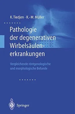 E-Book (pdf) Pathologie der degenerativen Wirbelsäulenerkrankungen von Kay Tiedjen, Klaus-Michael Müller