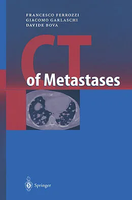 E-Book (pdf) CT of Metastases von Francesco Ferrozzi, Giacomo Garlaschi, Davide Bova