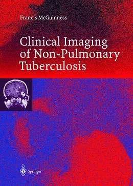 E-Book (pdf) Clinical Imaging in Non-Pulmonary Tuberculosis von Francis E. McGuinness
