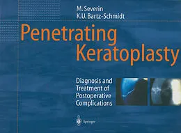 E-Book (pdf) Penetrating Keratoplasty von Maria Severin, Karl-Ulrich Bartz-Schmidt