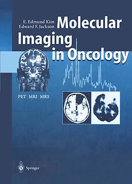 E-Book (pdf) Molecular Imaging in Oncology von E. Edmund Kim, Edward F. Jackson