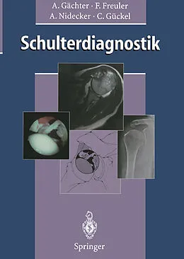 E-Book (pdf) Schulterdiagnostik von Andre Gächter, Franz Freuler, Andreas Nidecker