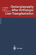 E-Book (pdf) Cholangiography After Orthotopic Liver Transplantation von Gerd Nöldge, Gerd Otto, Lorenz Theilmann