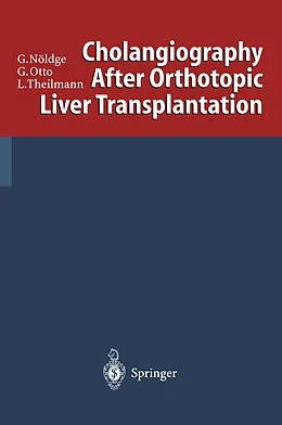 E-Book (pdf) Cholangiography After Orthotopic Liver Transplantation von Gerd Nöldge, Gerd Otto, Lorenz Theilmann