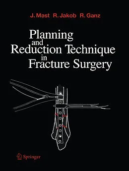E-Book (pdf) Planning and Reduction Technique in Fracture Surgery von Jeffrey Mast, Roland Jakob, Reinhold Ganz