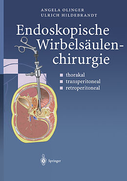 Kartonierter Einband Endoskopische Wirbelsäulenchirurgie von Angela Olinger, Ulrich Hildebrandt
