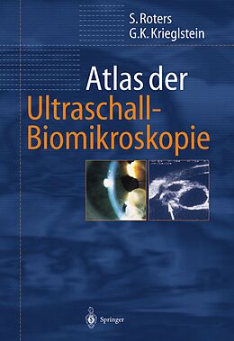 Kartonierter Einband Atlas der Ultraschall-Biomikroskopie von Sigrid Roters, Günter K. Krieglstein
