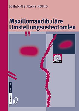 Kartonierter Einband Maxillomandibuläre Umstellungsosteotomien von Johannes-Franz Hönig