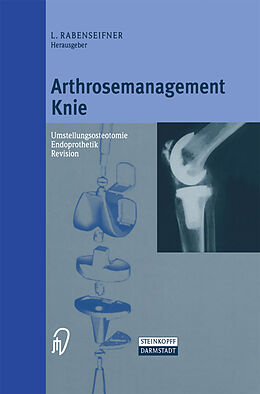Kartonierter Einband Arthrosemanagement Knie von 