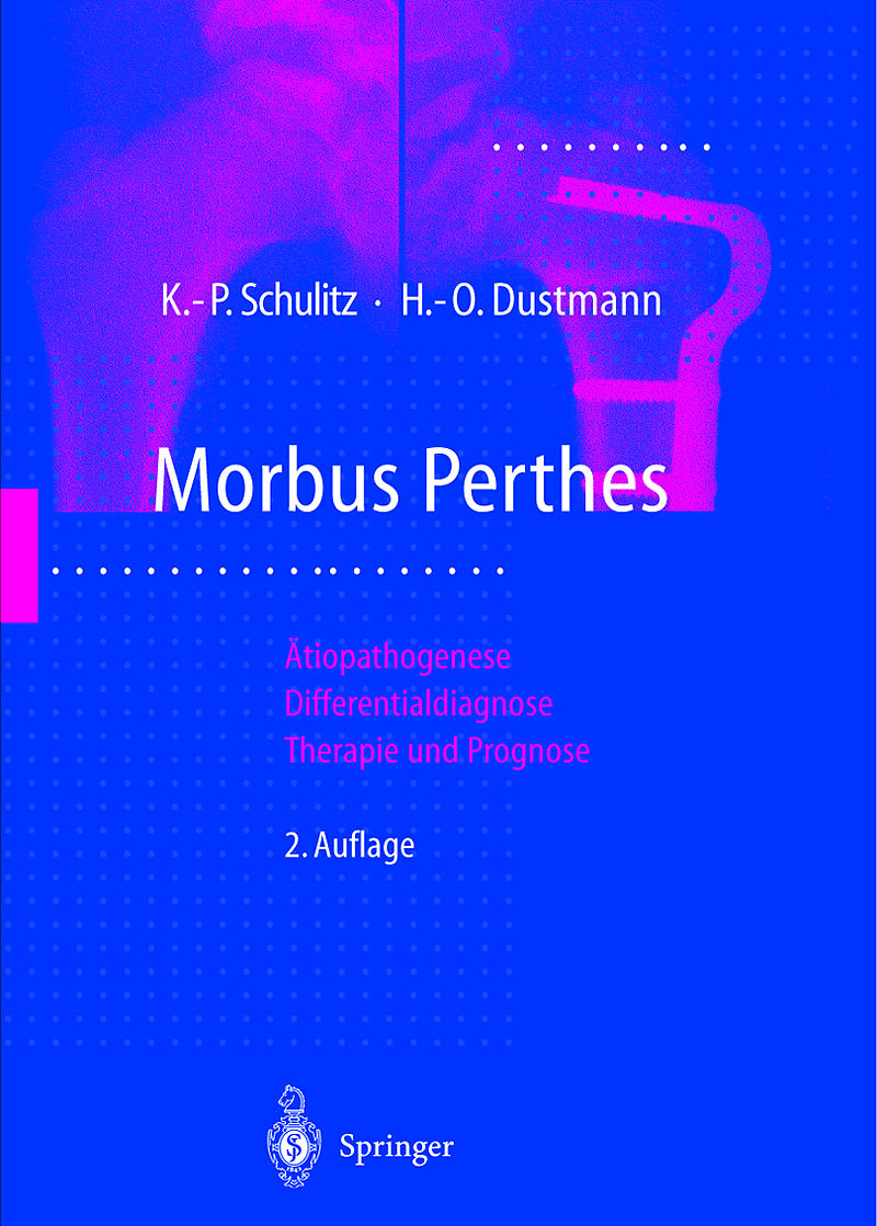 Morbus Perthes