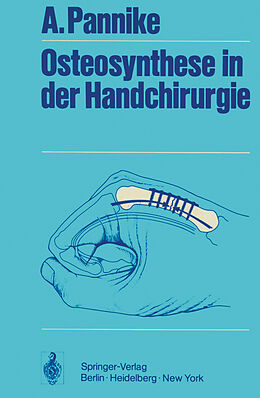 Kartonierter Einband Osteosynthese in der Handchirurgie von A. Pannike
