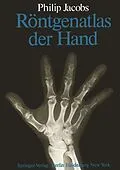 E-Book (pdf) Röntgenatlas der Hand von P. Jacobs