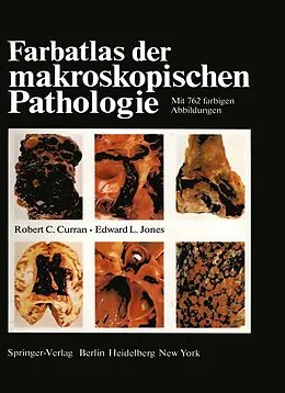 E-Book (pdf) Farbatlas der makroskopischen Pathologie von R. C. Curran, E. L. Jones