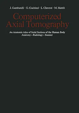 E-Book (pdf) Computerized Axial Tomography von J. Gambarelli, G. Guerinel, L. Chevrot