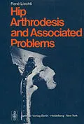 E-Book (pdf) Hip Arthrodesis and Associated Problems von R. Liechti