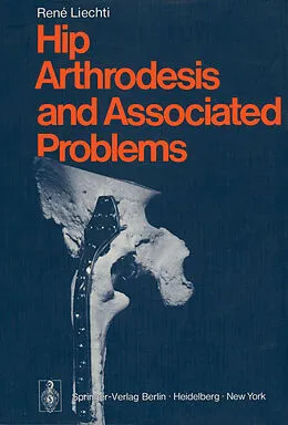 E-Book (pdf) Hip Arthrodesis and Associated Problems von R. Liechti