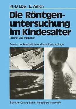 E-Book (pdf) Die Röntgenuntersuchung im Kindesalter von Klaus-D. Ebel, Eberhard Willich