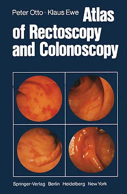 E-Book (pdf) Atlas of Rectoscopy and Coloscopy von P. Otto, K. Ewe