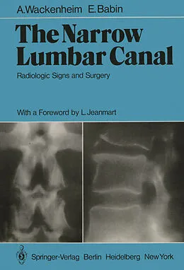 E-Book (pdf) The Narrow Lumbar Canal von A. Wackenheim, E. Babin
