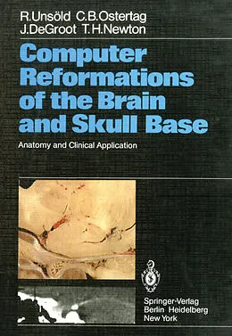 E-Book (pdf) Computer Reformations of the Brain and Skull Base von R. Unsöld, C. B. Ostertag, J. DeGroot