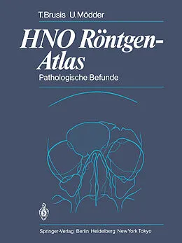 E-Book (pdf) HNO Röntgen-Atlas von Tilman Brusis, Ulrich Mödder