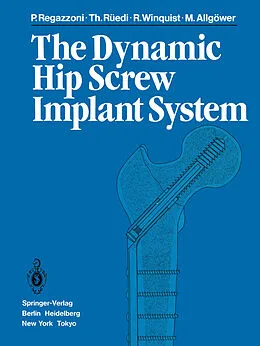 E-Book (pdf) The Dynamic Hip Screw Implant System von P. Regazzoni, T. Rüedi, R. Winquist
