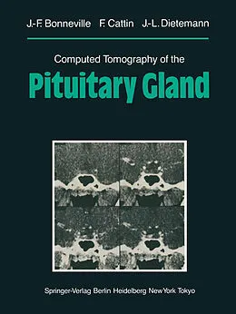 E-Book (pdf) Computed Tomography of the Pituitary Gland von Jean-Francois Bonneville, F. Cattin, Jean-Louis Dietemann