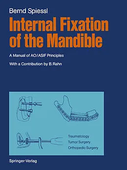 E-Book (pdf) Internal Fixation of the Mandible von Bernd Spiessl