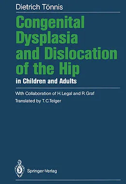 E-Book (pdf) Congenital Dysplasia and Dislocation of the Hip in Children and Adults von Dietrich Tönnis